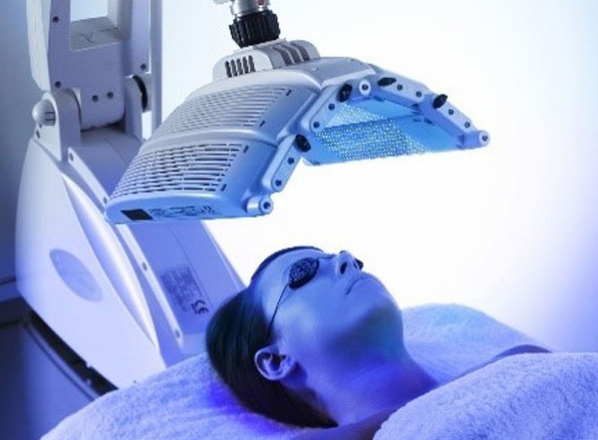 Photodynamic therapy of Acne 